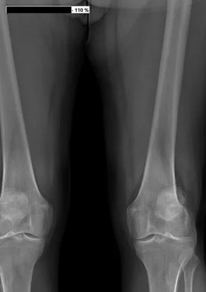 Radiographie du bassin imprimée à taille réelle en format A3